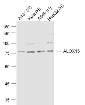 ALOX15 Rabbit Polyclonal Antibody