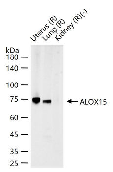 ALOX15 Rabbit Polyclonal Antibody