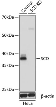 SCD Rabbit Polyclonal Antibody