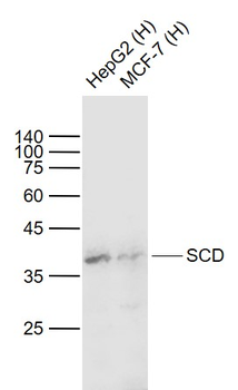 SCD Rabbit Polyclonal Antibody