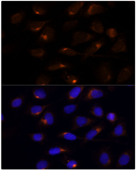 SCD Rabbit Polyclonal Antibody