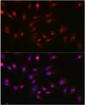 PARP1 Rabbit Polyclonal Antibody