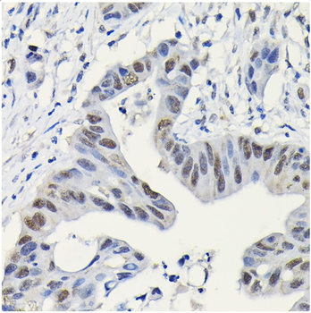 PARP1 Rabbit Polyclonal Antibody