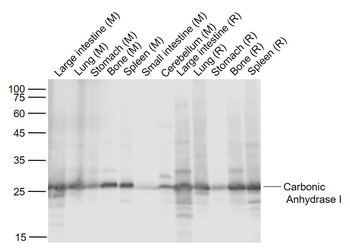 Carbonic Anhydrase I Recombinant Rabbit Monoclonal Antibody
