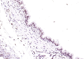 Beclin 1 Rabbit Polyclonal Antibody