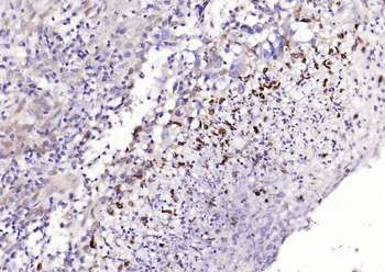 Cyclooxygenase 2 Recombinant Rabbit Monoclonal Antibody