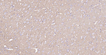 Sodium Potassium ATPase Mouse Monoclonal Antibody