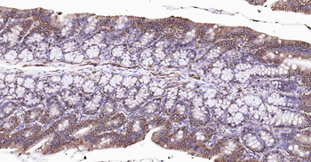 Sodium Potassium ATPase Mouse Monoclonal Antibody