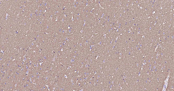 Sodium Potassium ATPase Mouse Monoclonal Antibody