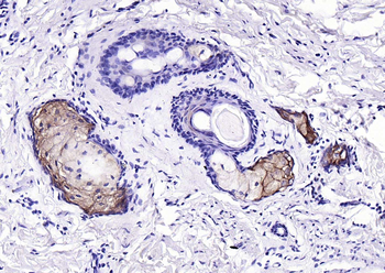 Fatty Acid Synthase Recombinant Rabbit Monoclonal Antibody