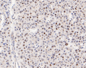 ATF4 Recombinant Rabbit Monoclonal Antibody