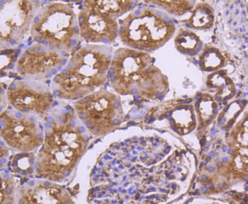 Calnexin Recombinant Rabbit Monoclonal Antibody