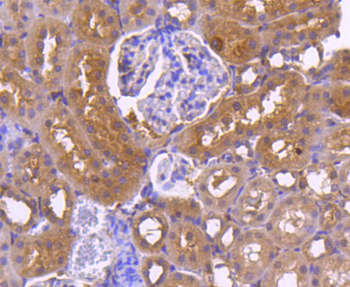 Calnexin Recombinant Rabbit Monoclonal Antibody