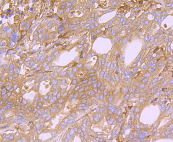 ARP3 Recombinant Rabbit Monoclonal Antibody