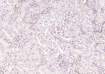 CSNK2B/CK II beta Recombinant Rabbit Monoclonal Antibody