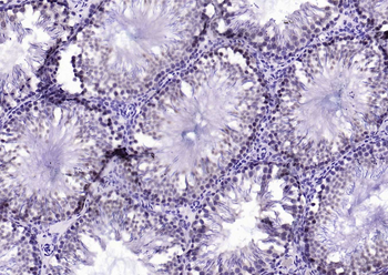 CSNK2B/CK II beta Recombinant Rabbit Monoclonal Antibody