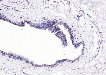 CSNK2B/CK II beta Recombinant Rabbit Monoclonal Antibody