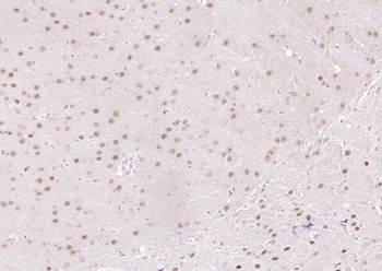 CSNK2B/CK II beta Recombinant Rabbit Monoclonal Antibody