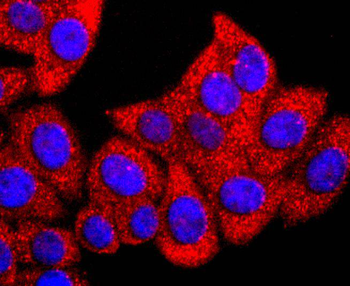 GLI1 Recombinant Rabbit Monoclonal Antibody