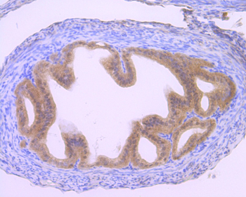 GLI1 Recombinant Rabbit Monoclonal Antibody