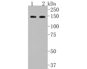GLI1 Recombinant Rabbit Monoclonal Antibody
