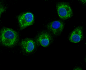 GCLM Recombinant Rabbit Monoclonal Antibody