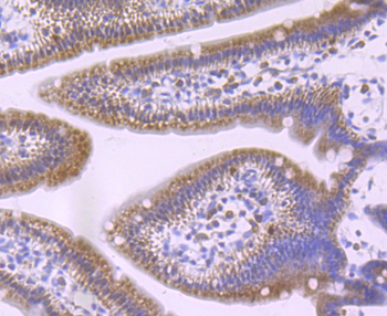 GCLM Recombinant Rabbit Monoclonal Antibody