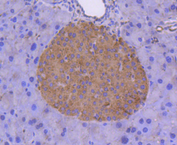 Tissue factor Recombinant Rabbit Monoclonal Antibody