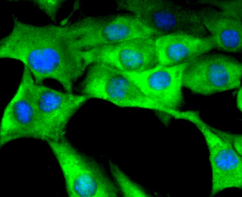 Tissue factor Recombinant Rabbit Monoclonal Antibody