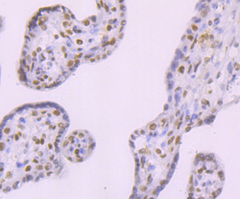 DNA Ligase IV Recombinant Rabbit Monoclonal Antibody
