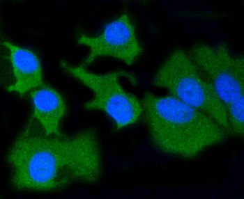 MMP14 Recombinant Rabbit Monoclonal Antibody