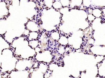 Phospho C-Myc (Thr58 / Ser62) Rabbit Polyclonal Antibody