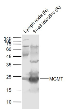 MGMT Rabbit Polyclonal Antibody