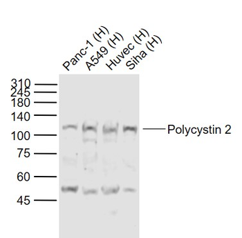 Polycystin 2 Rabbit Polyclonal Antibody