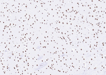YY1 Recombinant Rabbit Monoclonal Antibody (Nuclear Loading Control)