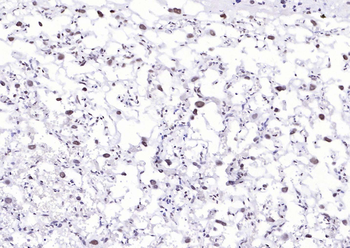 YY1 Recombinant Rabbit Monoclonal Antibody (Nuclear Loading Control)
