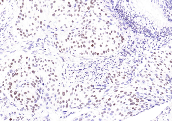 YY1 Recombinant Rabbit Monoclonal Antibody (Nuclear Loading Control)