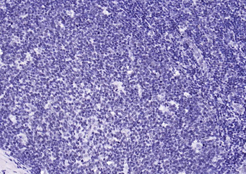 YY1 Recombinant Rabbit Monoclonal Antibody (Nuclear Loading Control)