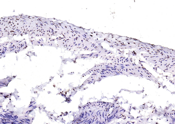YY1 Recombinant Rabbit Monoclonal Antibody (Nuclear Loading Control)