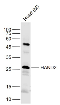 HAND2 Rabbit Polyclonal Antibody