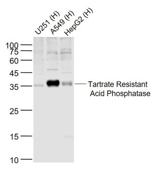 Tartrate Resistant Acid Phosphatase Rabbit Polyclonal Antibody