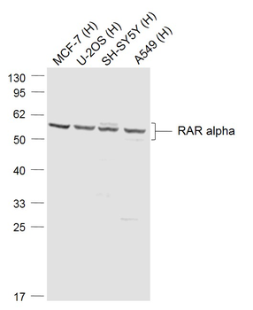 RAR alpha Rabbit Polyclonal Antibody