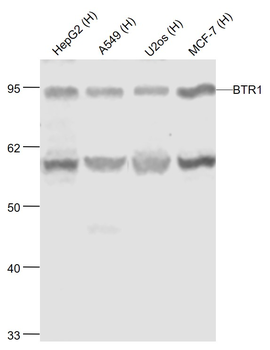 BTR1 Rabbit Polyclonal Antibody