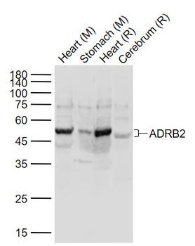 ADRB2 Rabbit Polyclonal Antibody