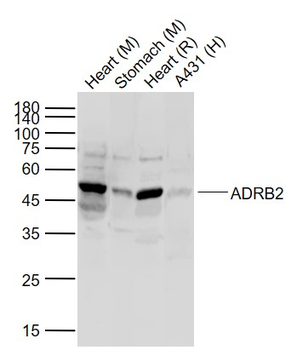 ADRB2 Rabbit Polyclonal Antibody