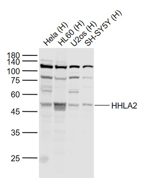 HHLA2 Rabbit Polyclonal Antibody