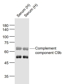 Complement component C9b Rabbit Polyclonal Antibody