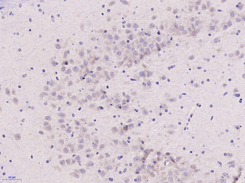 IL17E Rabbit Polyclonal Antibody