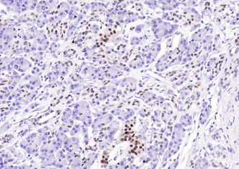 PDX1 Recombinant Rabbit Monoclonal Antibody