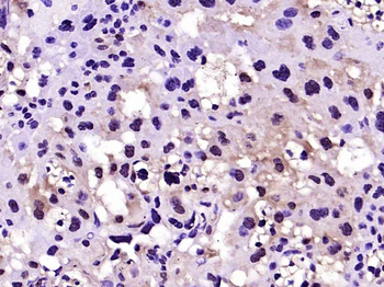 HAND2 Rabbit Polyclonal Antibody